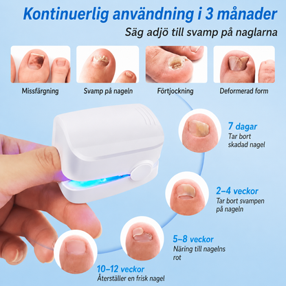 NagelLjus™ – Smidig ljusbehandling för nagelvård hemma