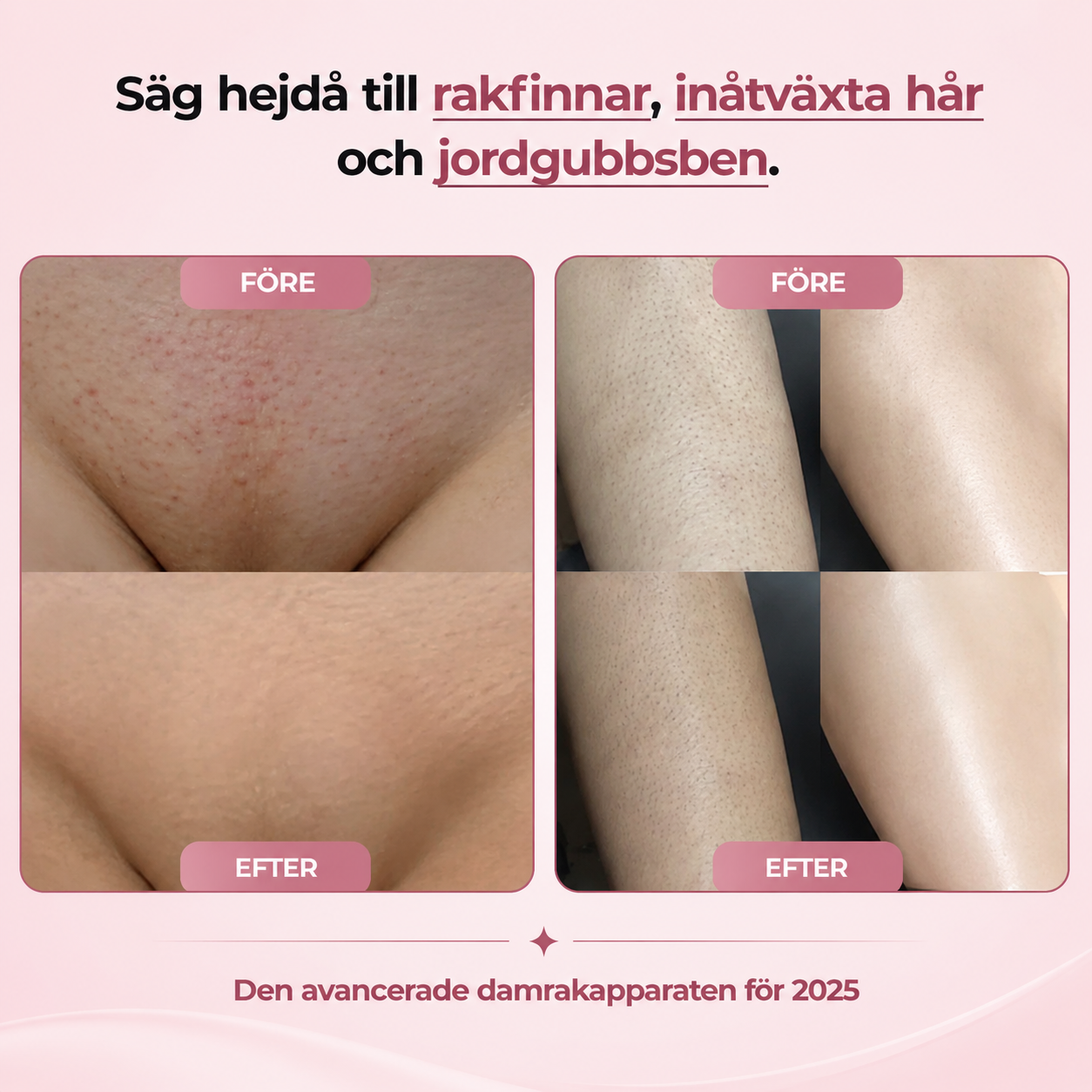 NordTrim™ – Kroppstrimmer för hela kroppen