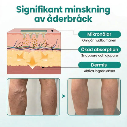 VenaLätt™  – Mikronål-patch för venstöd och lindring av tunga ben