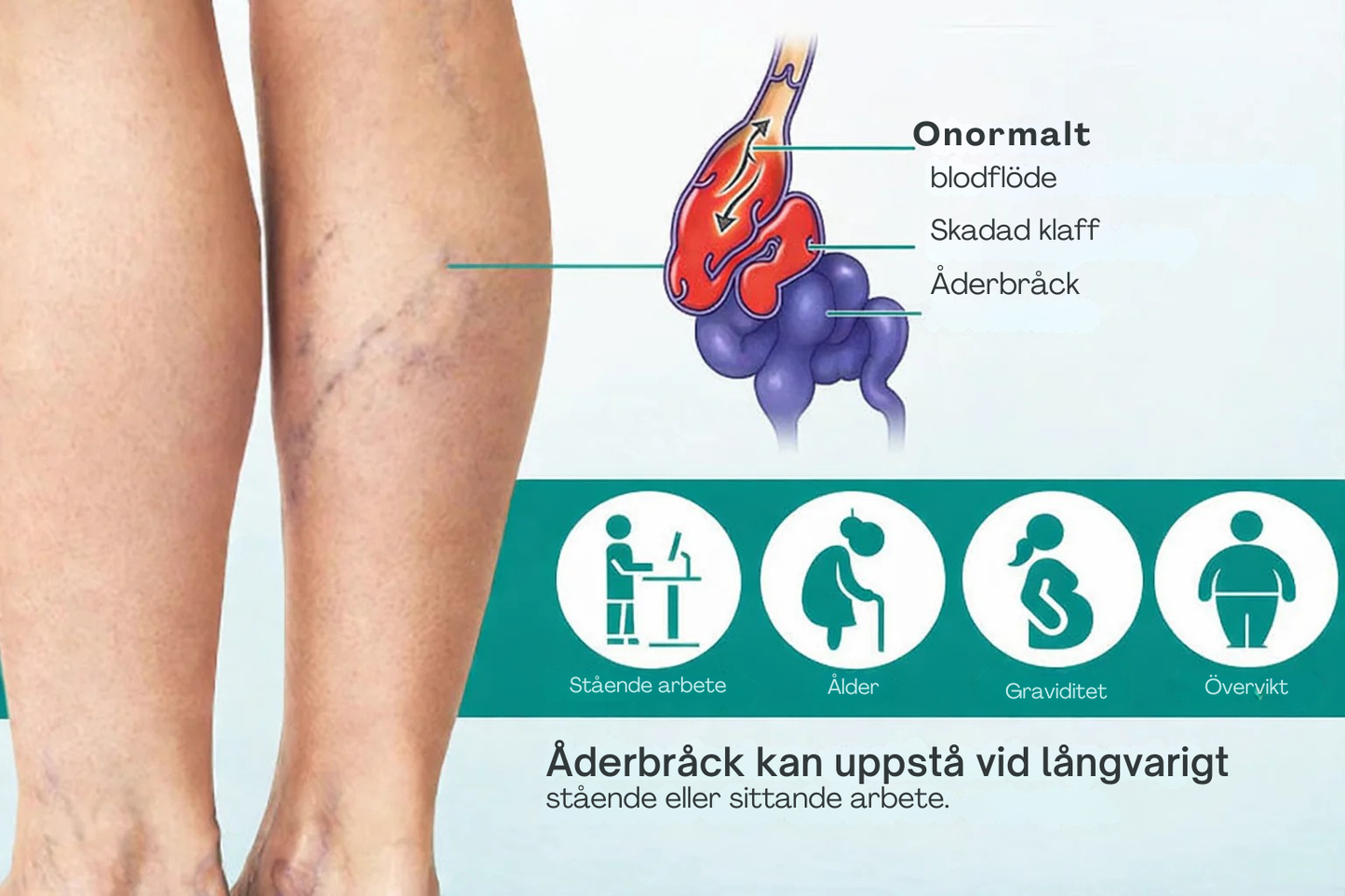 VenaLätt™  – Mikronål-patch för venstöd och lindring av tunga ben